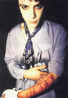 Richey Edwards carved the words 4 Real into his forearm